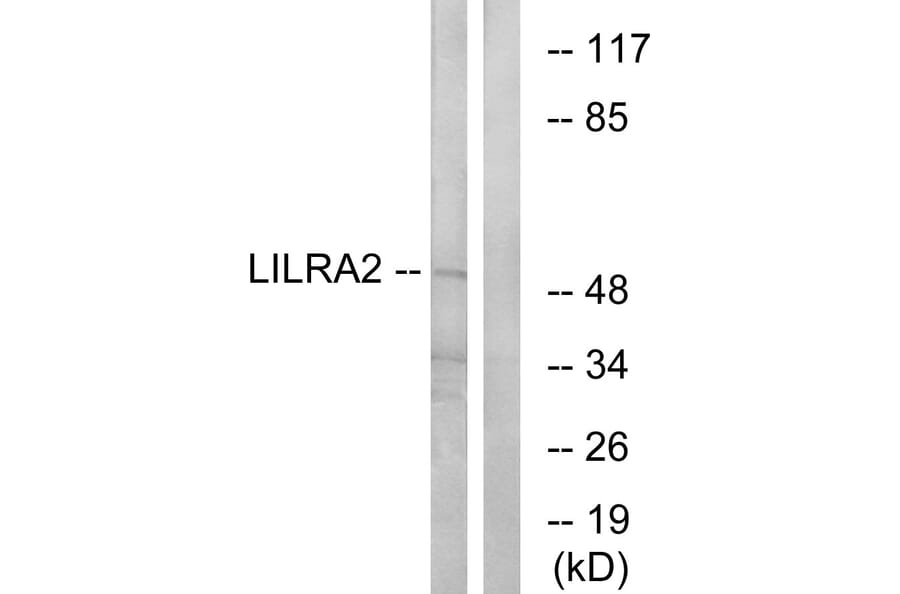 Western Blot - Anti-LILRA2 Antibody (C16462) - Antibodies.com
