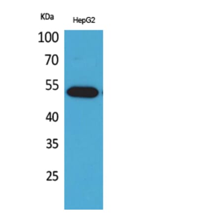 Western Blot - Anti-LILRA2 Antibody (C30393) - Antibodies.com