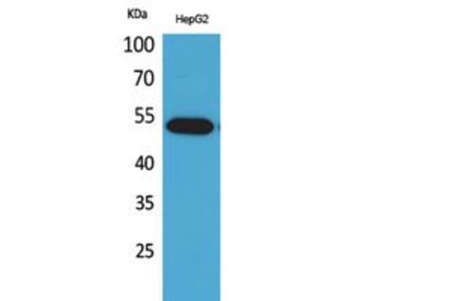 Western Blot - Anti-LILRA2 Antibody (C30393) - Antibodies.com