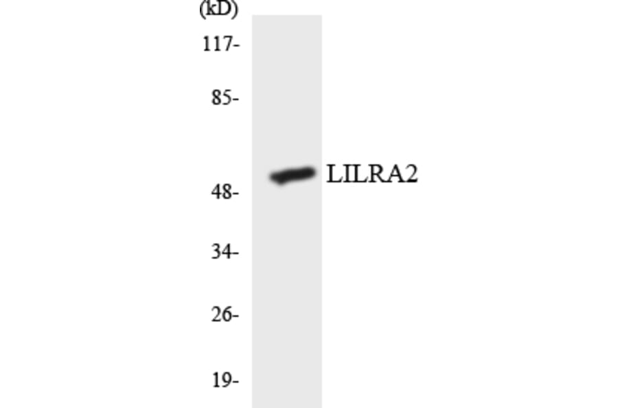 Western Blot - Anti-LILRA2 Antibody (R12-2967) - Antibodies.com