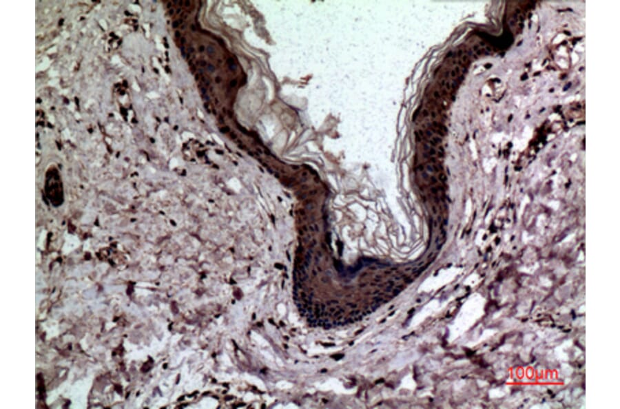 Immunohistochemistry - Anti-LGALS3 Antibody (C30072) - Antibodies.com