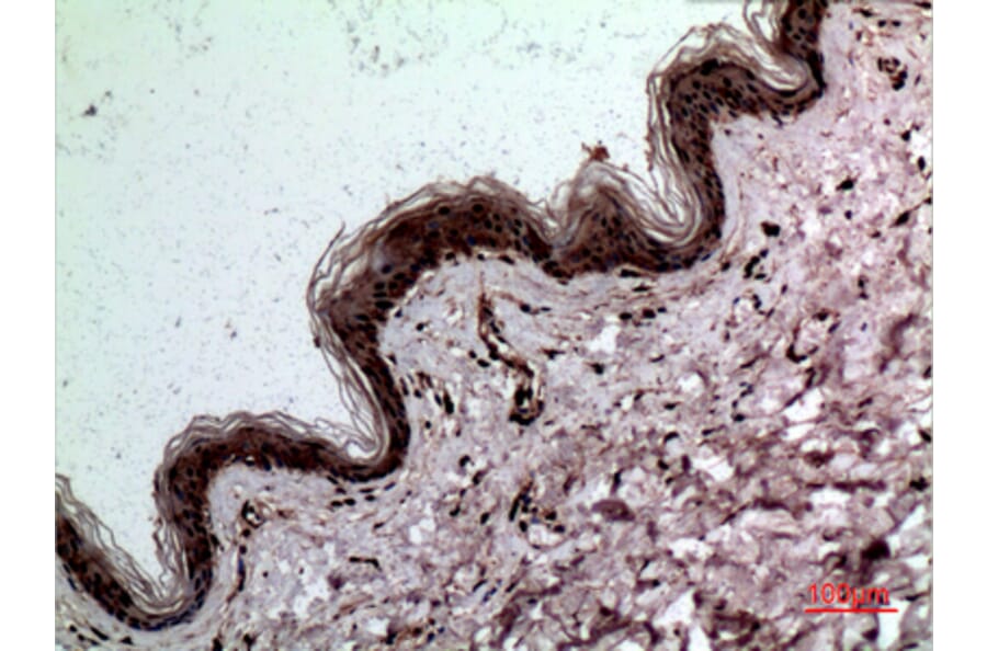 Immunohistochemistry - Anti-LGALS3 Antibody (C30072) - Antibodies.com