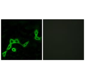 Immunofluorescence - Anti-KISS1R Antibody (G373) - Antibodies.com