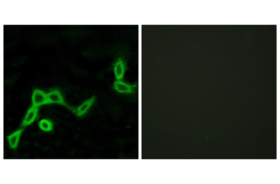 Immunofluorescence - Anti-KISS1R Antibody (G373) - Antibodies.com
