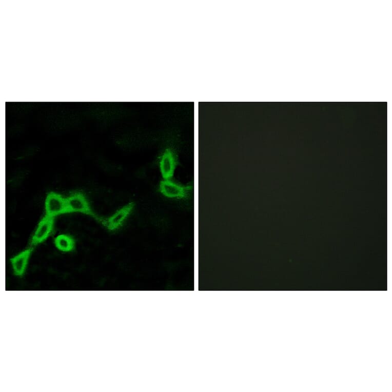 Immunofluorescence - Anti-KISS1R Antibody (G373) - Antibodies.com