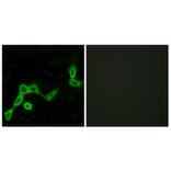 Immunofluorescence - Anti-KISS1R Antibody (G373) - Antibodies.com