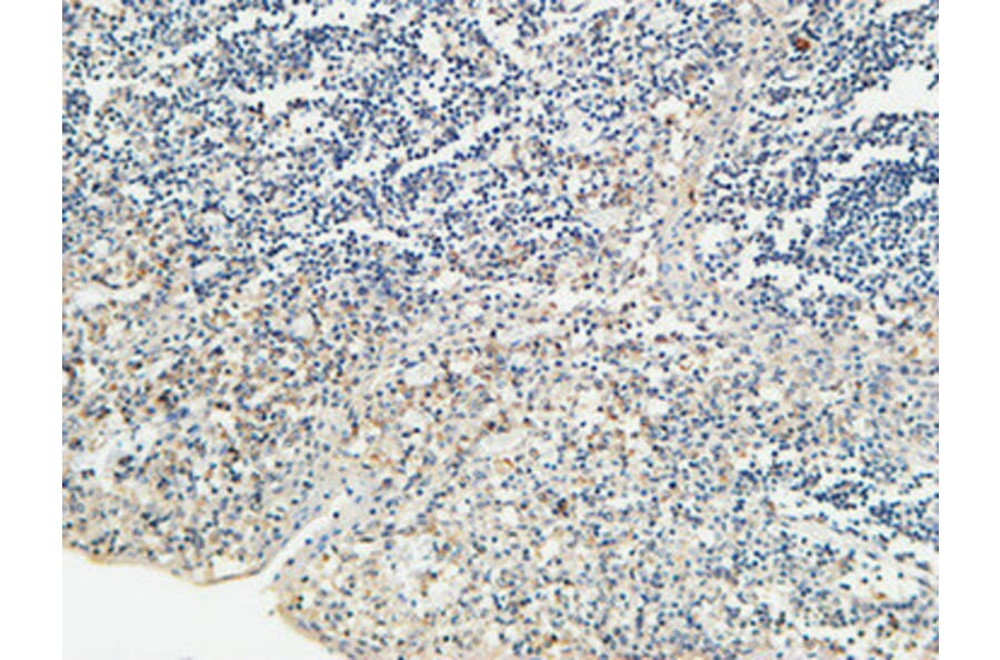 Immunohistochemistry - Anti-KISS1R Antibody (G373) - Antibodies.com