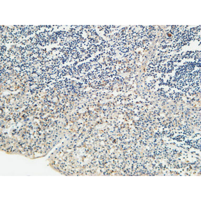 Immunohistochemistry - Anti-KISS1R Antibody (G373) - Antibodies.com