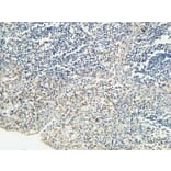 Immunohistochemistry - Anti-KISS1R Antibody (G373) - Antibodies.com