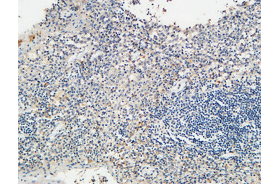 Immunohistochemistry - Anti-KISS1R Antibody (G373) - Antibodies.com
