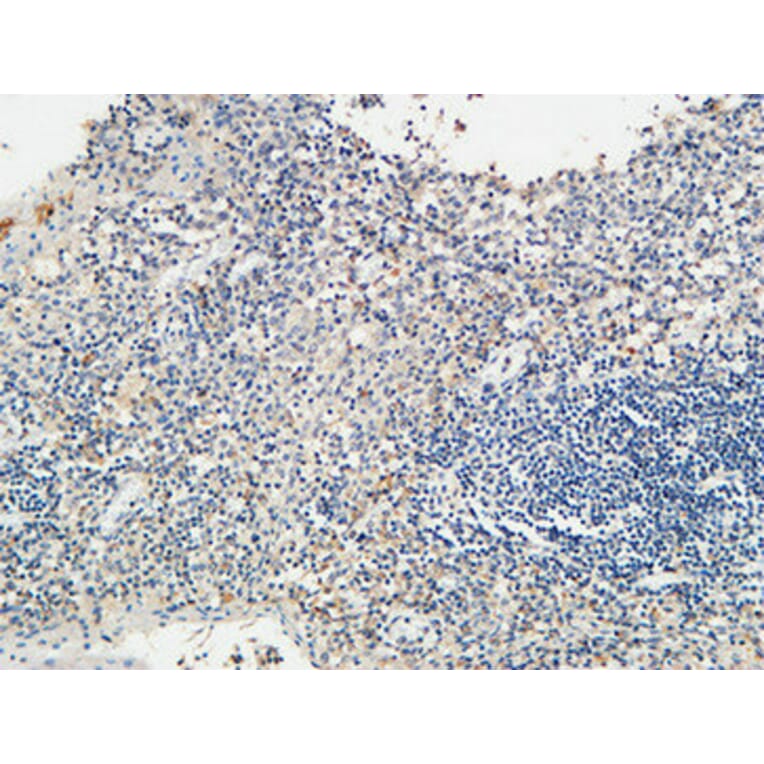 Immunohistochemistry - Anti-KISS1R Antibody (G373) - Antibodies.com