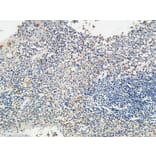 Immunohistochemistry - Anti-KISS1R Antibody (G373) - Antibodies.com