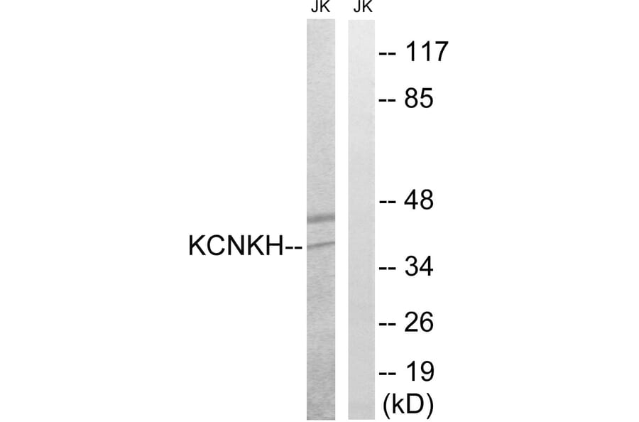 Western Blot - Anti-KCNK17 Antibody (C17780) - Antibodies.com
