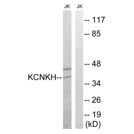 Western Blot - Anti-KCNK17 Antibody (C17780) - Antibodies.com