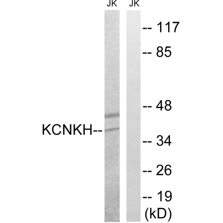 Western Blot - Anti-KCNK17 Antibody (C17780) - Antibodies.com