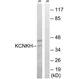 Western Blot - Anti-KCNK17 Antibody (C17780) - Antibodies.com