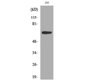 Western Blot - Anti-IL18R1 Antibody (C30446) - Antibodies.com