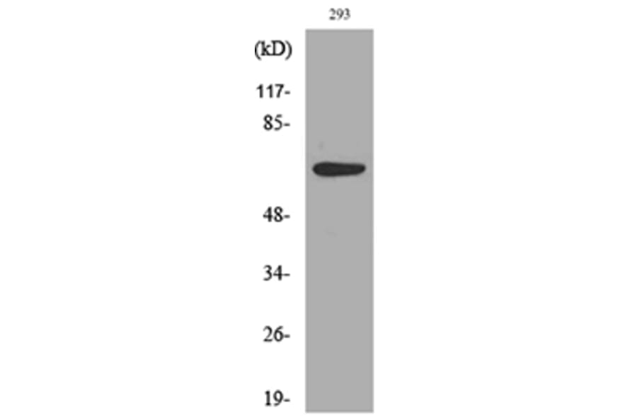 Western Blot - Anti-IL18R1 Antibody (C30446) - Antibodies.com