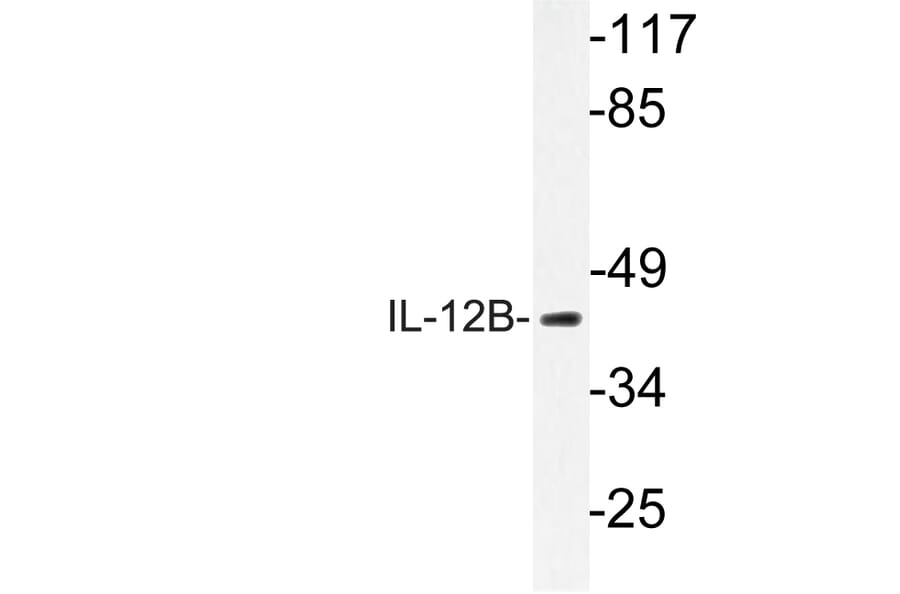 Western Blot - Anti-IL-12B Antibody (R12-2201) - Antibodies.com