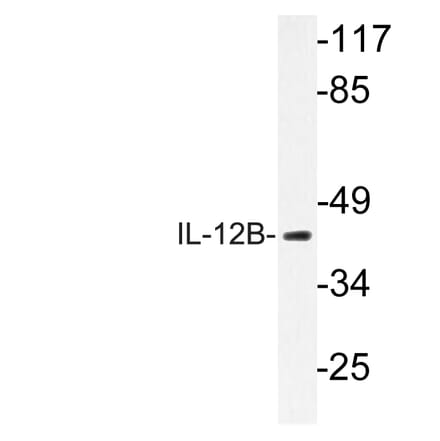 Western Blot - Anti-IL-12B Antibody (R12-2201) - Antibodies.com