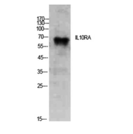 Western Blot - Anti-IL10RA Antibody (C30525) - Antibodies.com