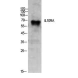 Western Blot - Anti-IL10RA Antibody (C30525) - Antibodies.com