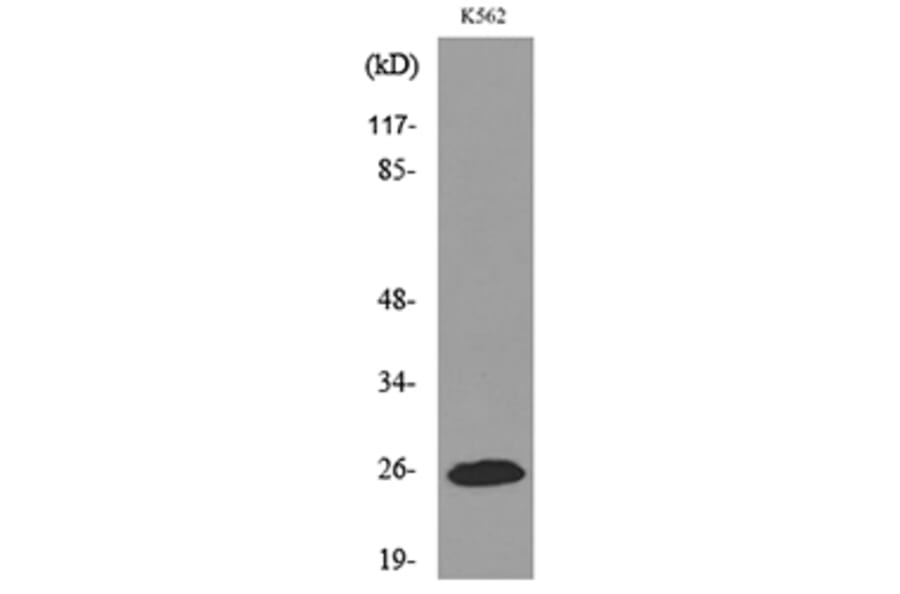 Western Blot - Anti-IGFBP6 Antibody (C30055) - Antibodies.com