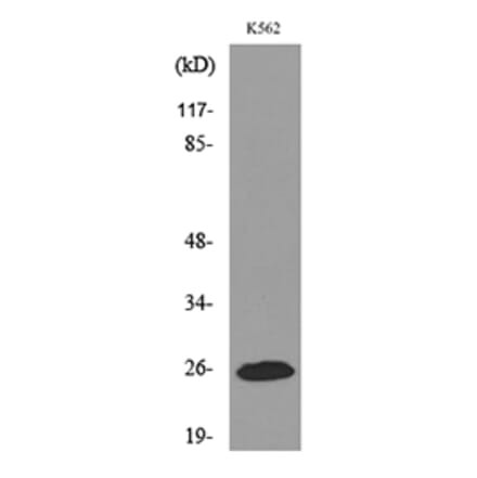 Western Blot - Anti-IGFBP6 Antibody (C30055) - Antibodies.com