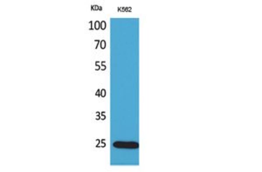 Western Blot - Anti-IGFBP6 Antibody (C30055) - Antibodies.com