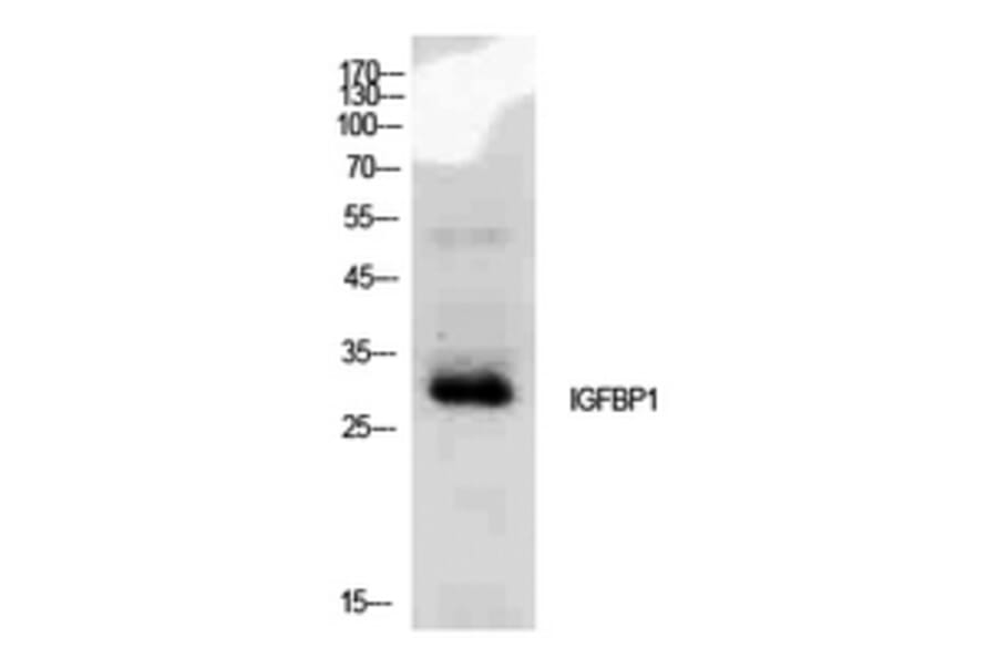 Western Blot - Anti-IGFBP1 Antibody (C30203) - Antibodies.com