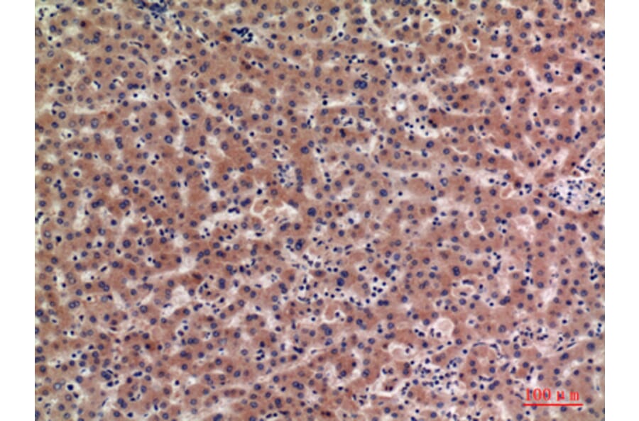 Immunohistochemistry - Anti-IGFBP1 Antibody (C30203) - Antibodies.com
