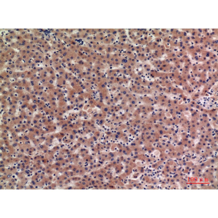 Immunohistochemistry - Anti-IGFBP1 Antibody (C30203) - Antibodies.com