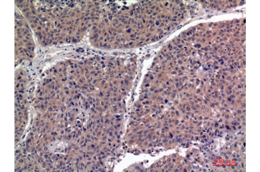 Immunohistochemistry - Anti-IGFBP1 Antibody (C30203) - Antibodies.com