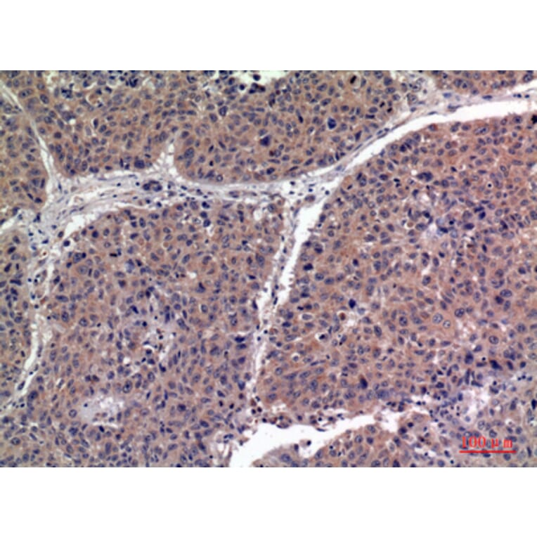 Immunohistochemistry - Anti-IGFBP1 Antibody (C30203) - Antibodies.com