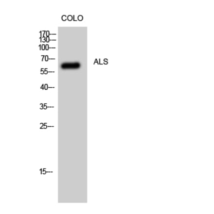 Western Blot - Anti-IGFALS Antibody (C20507) - Antibodies.com