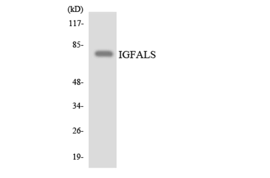 Western Blot - Anti-IGFALS Antibody (R12-2913) - Antibodies.com