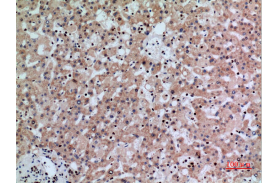 Immunohistochemistry - Anti-IFNGR1 Antibody (C30421) - Antibodies.com