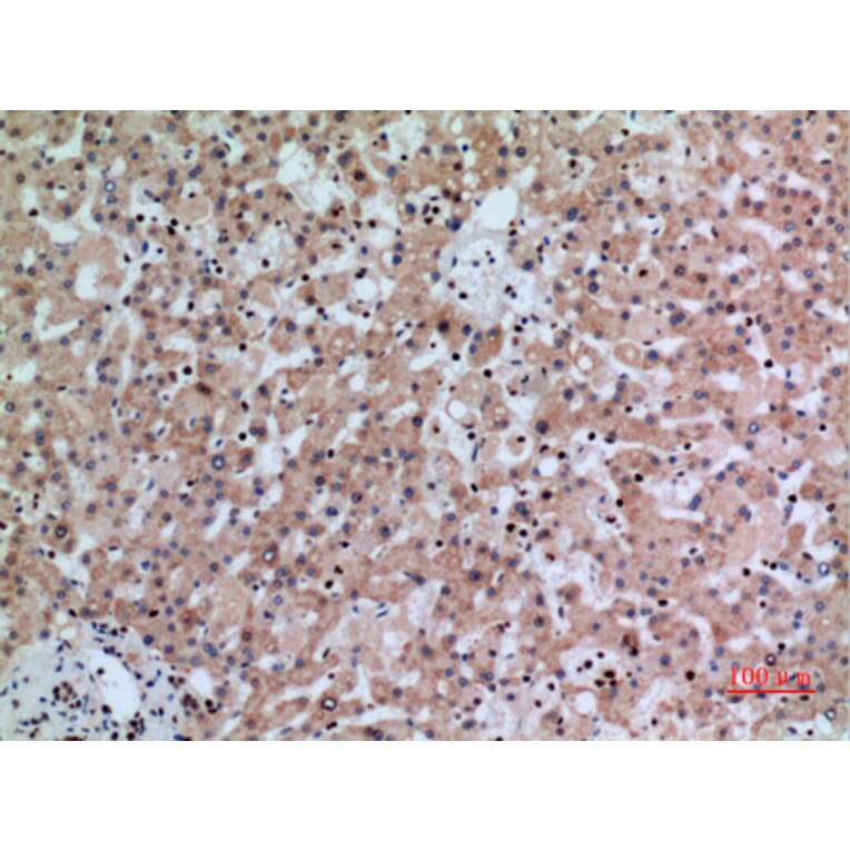 Immunohistochemistry - Anti-IFNGR1 Antibody (C30421) - Antibodies.com