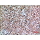 Immunohistochemistry - Anti-IFNGR1 Antibody (C30421) - Antibodies.com