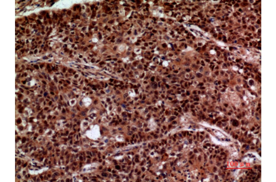 Immunohistochemistry - Anti-IFNGR1 Antibody (C30421) - Antibodies.com
