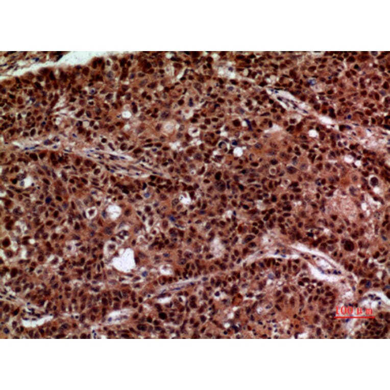 Immunohistochemistry - Anti-IFNGR1 Antibody (C30421) - Antibodies.com