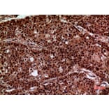 Immunohistochemistry - Anti-IFNGR1 Antibody (C30421) - Antibodies.com