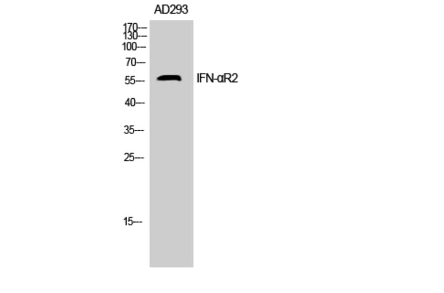 Western Blot - Anti-IFNAR2 Antibody (C30094) - Antibodies.com