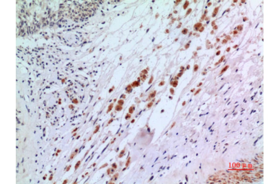 Immunohistochemistry - Anti-IFNAR2 Antibody (C30094) - Antibodies.com