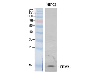 Western Blot - Anti-IFITM2 Antibody (C30976) - Antibodies.com