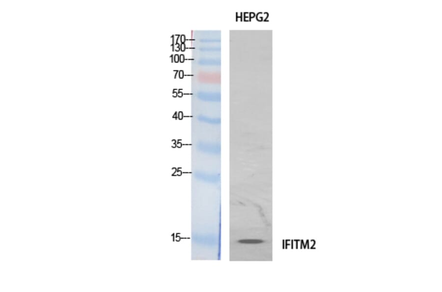 Western Blot - Anti-IFITM2 Antibody (C30976) - Antibodies.com