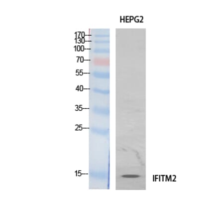 Western Blot - Anti-IFITM2 Antibody (C30976) - Antibodies.com