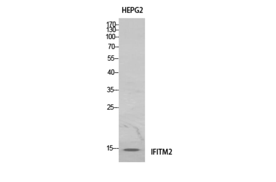 Western Blot - Anti-IFITM2 Antibody (C30976) - Antibodies.com