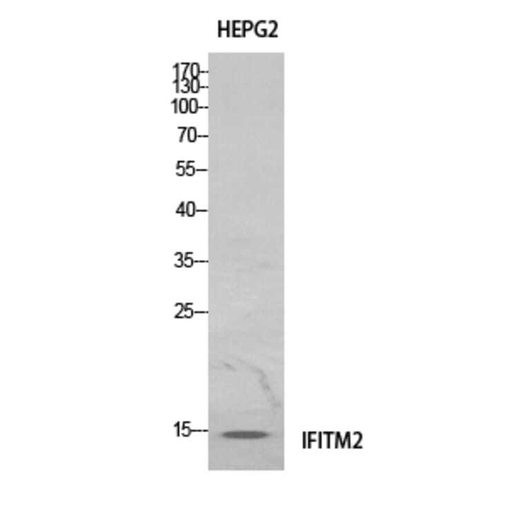 Western Blot - Anti-IFITM2 Antibody (C30976) - Antibodies.com