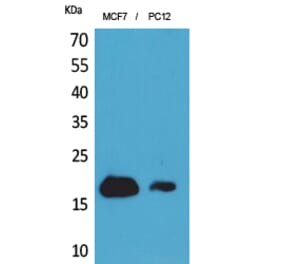 Western Blot - Anti-IFITM1 Antibody (C30521) - Antibodies.com
